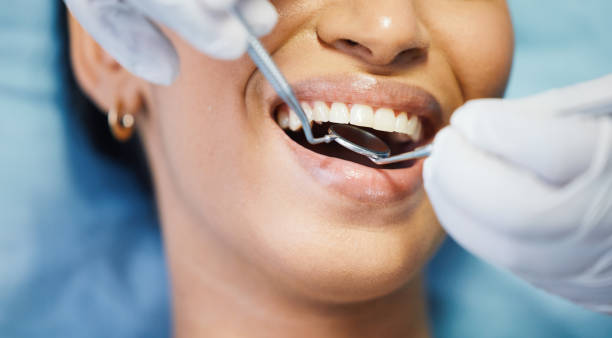 Best Emergency Wisdom Teeth Removal in Homer, MI